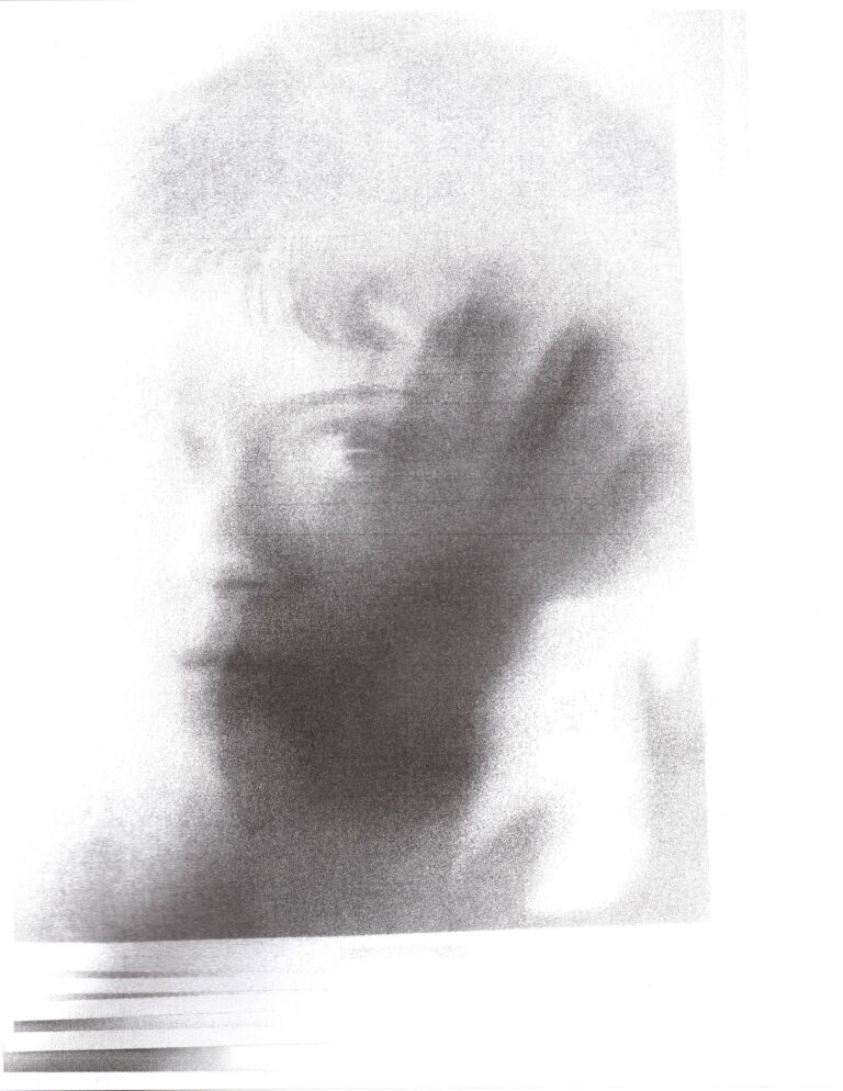 Scan 5